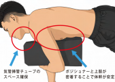 手術用器具 Procare Foam Series Upper Extremity Positioner 骨折手術で使用するウレタンポジショナー
